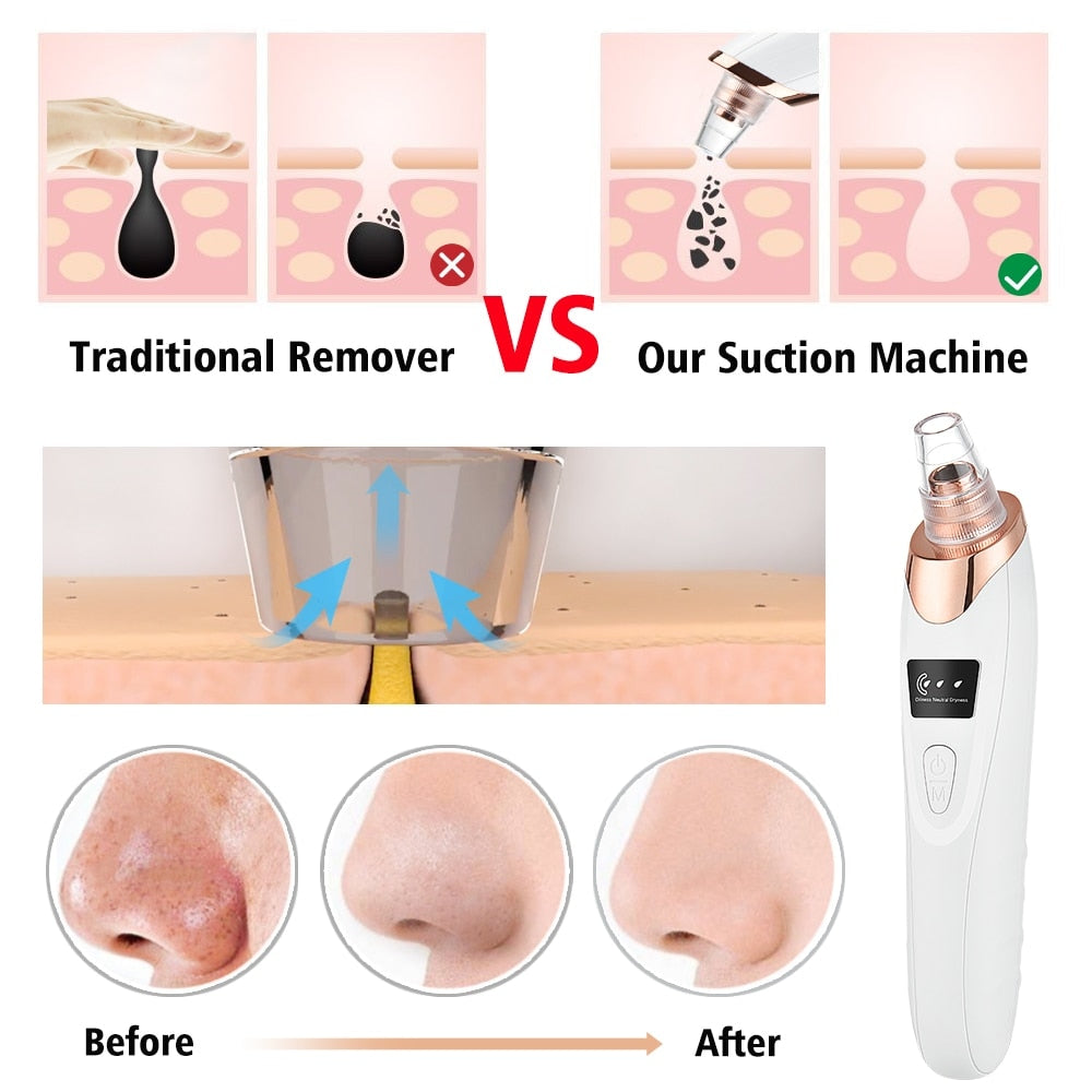 Multifunctional Cleaning Instrument